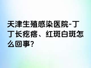 天津生殖感染医院-丁丁长疙瘩、红斑白斑怎么回事？